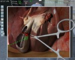   2011/Chirurgie-Simulator 2011 (2010/DE/PC)